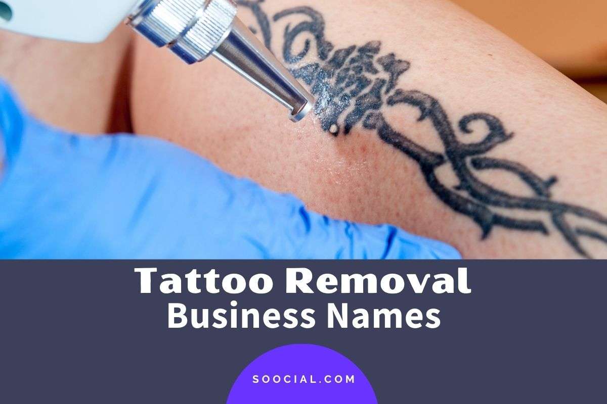 229 Catchy Tattoo Removal Business Name Ideas