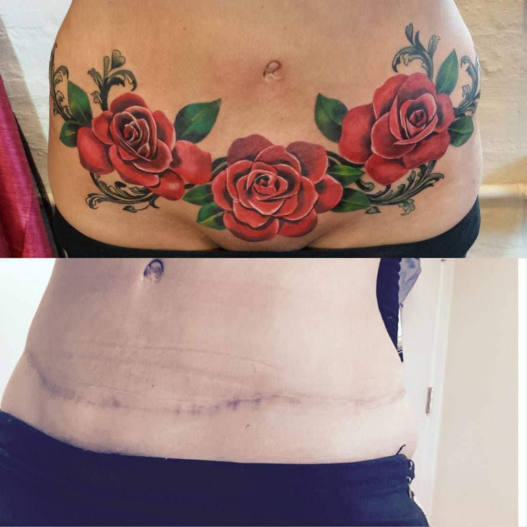 +27 Tattoos That Cover Up Tummy Tuck Scars References