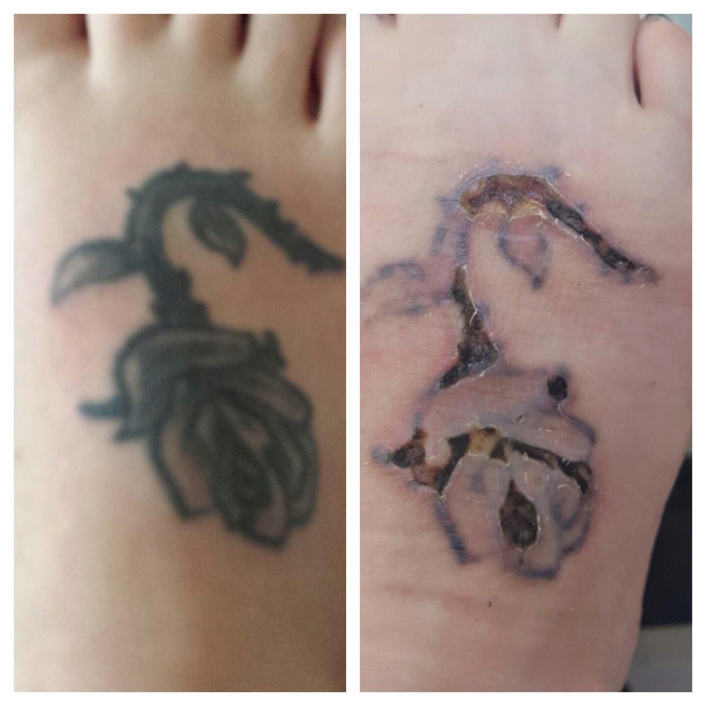 28+ Small Tattoo Before And After Healing