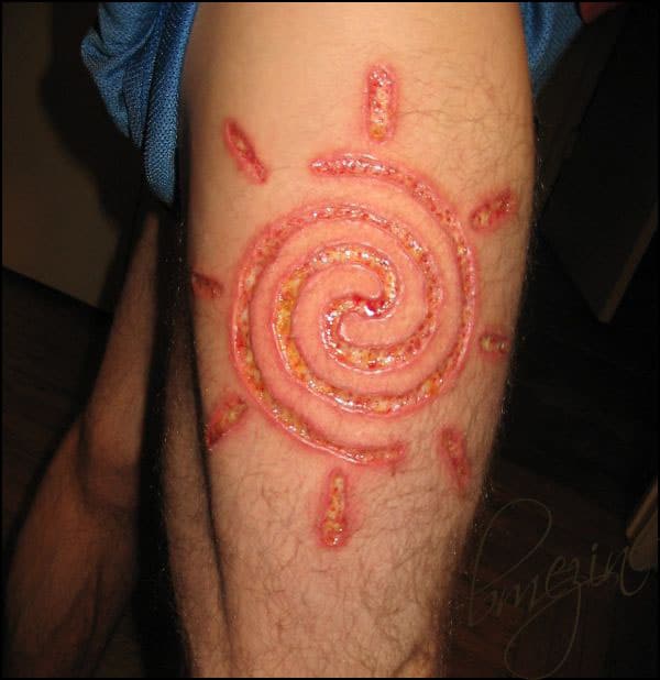 6 Steps How to Treat an Infected Tattoo