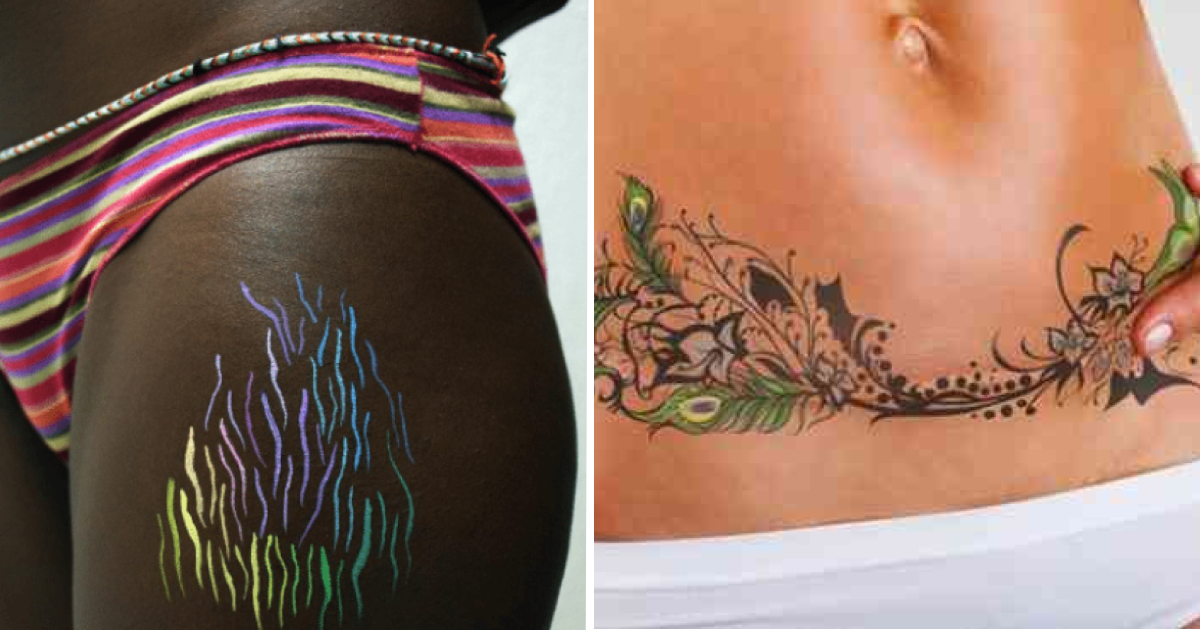 75 Times artists transformed stretch marks and scars into beautiful ...