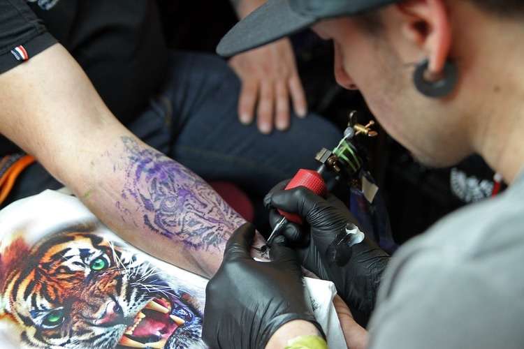 About Liability Insurance for Tattoos, Tattoo Removal