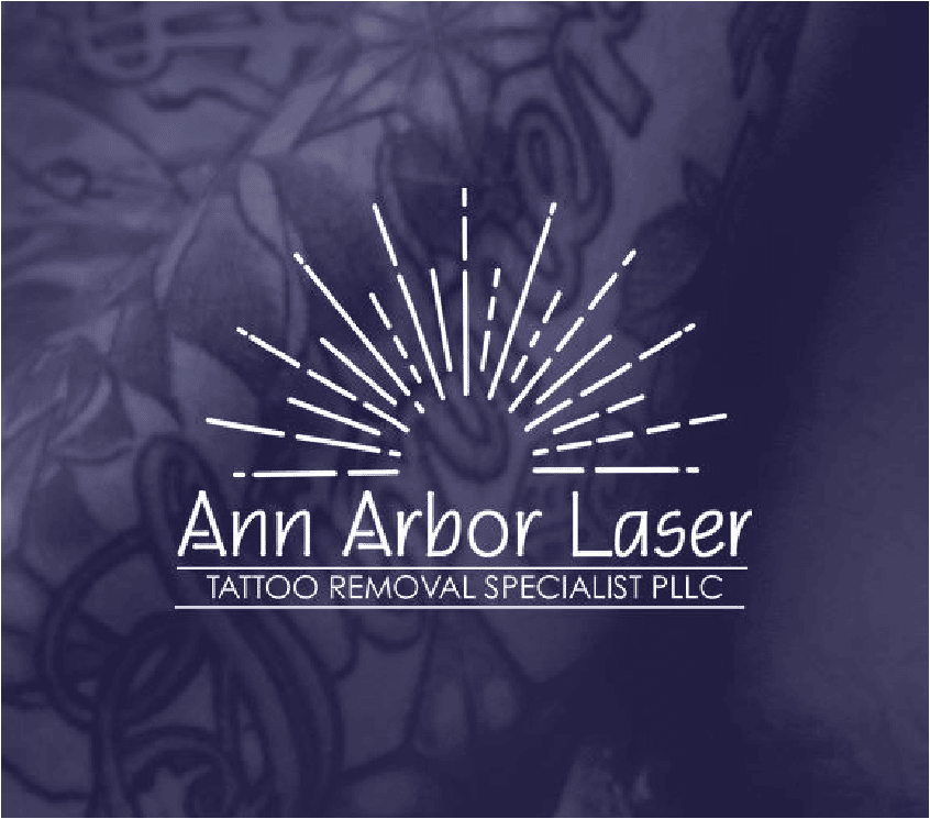 Ann Arbor Laser Tattoo, Laser Hair Removal Tattoo Lightening