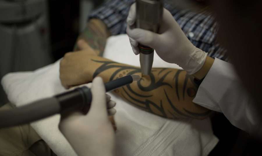 Becoming a Laser Tattoo Removal Specialist