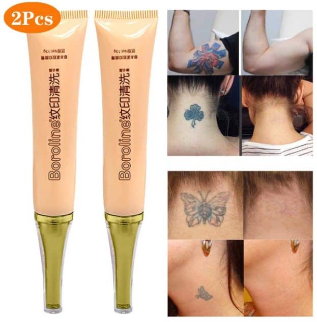 Best Tattoo Removal Cream: Reviews and Buying Guide 2020 ...