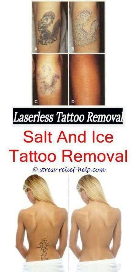best tattoo removal how much do tattoo removal specialist ...