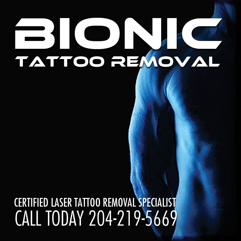 Bionic Tattoo Removal in Winnipeg  Read 3 Reviews