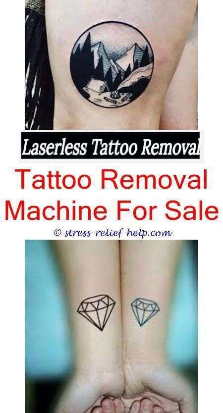 black tattoo removal how can you get a tattoo removed ...