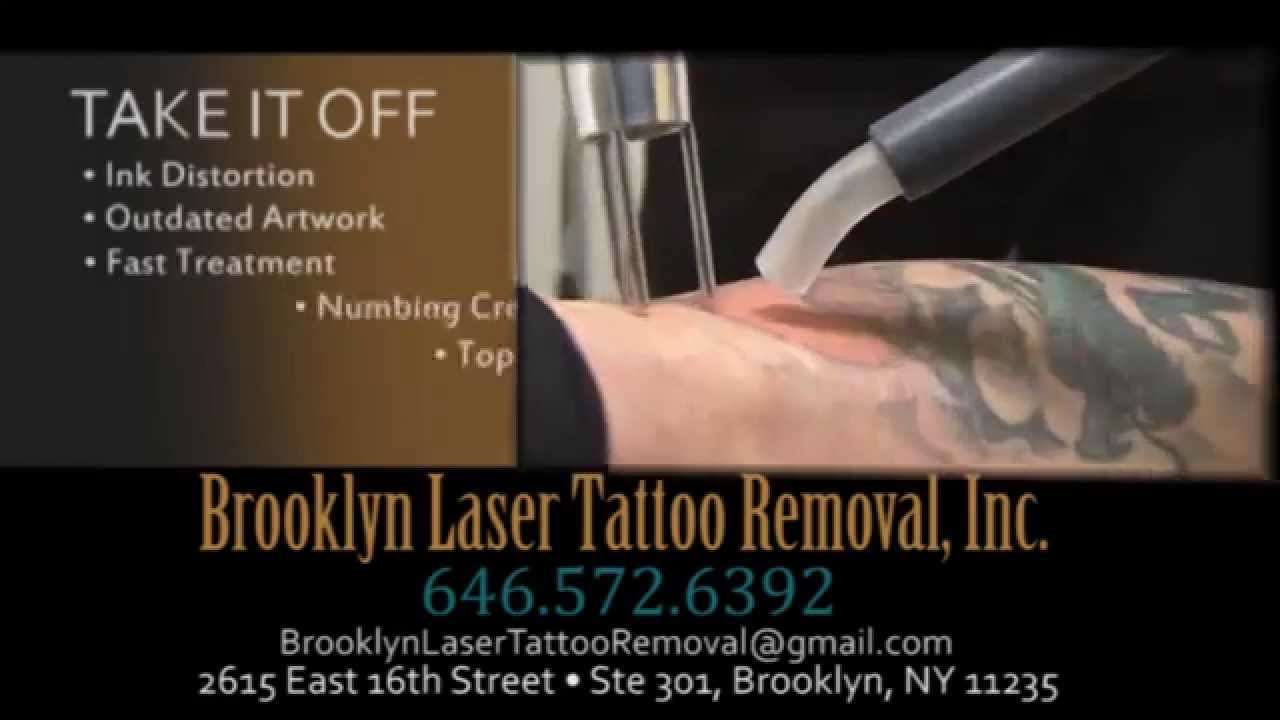 Brooklyn Laser Tattoo Removal Inc. Tattoo Removal NYC 646.572.6392 ...