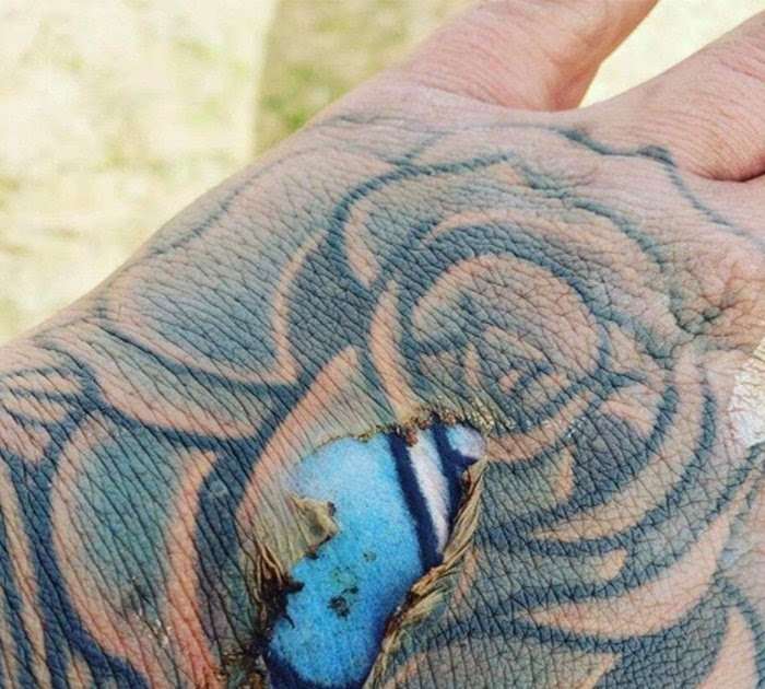 Can I Peel My Tattoo
