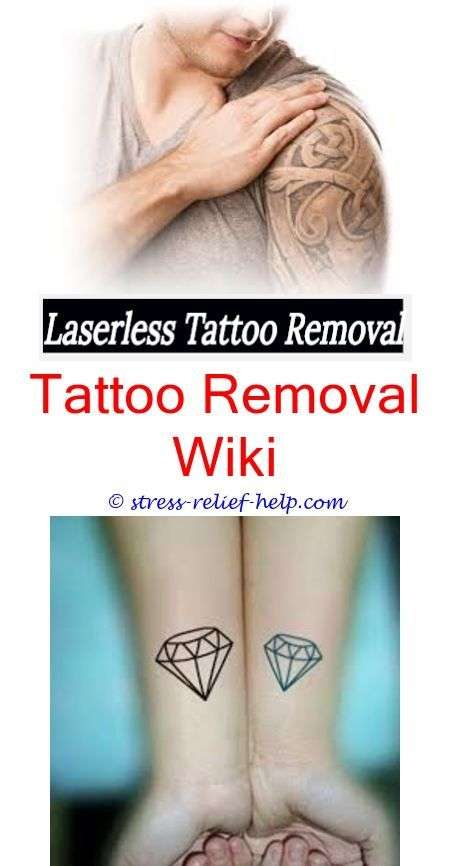 Can tattoos be removed without scarring.Tattoo removal ...