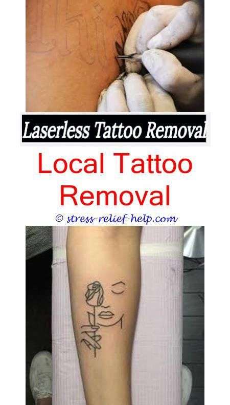 Can u get a tattoo removed while pregnant.How to remove temporary ...