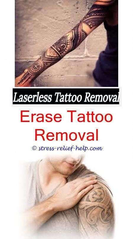 Can you get a tattoo removed while your pregnant.How to at home remove ...