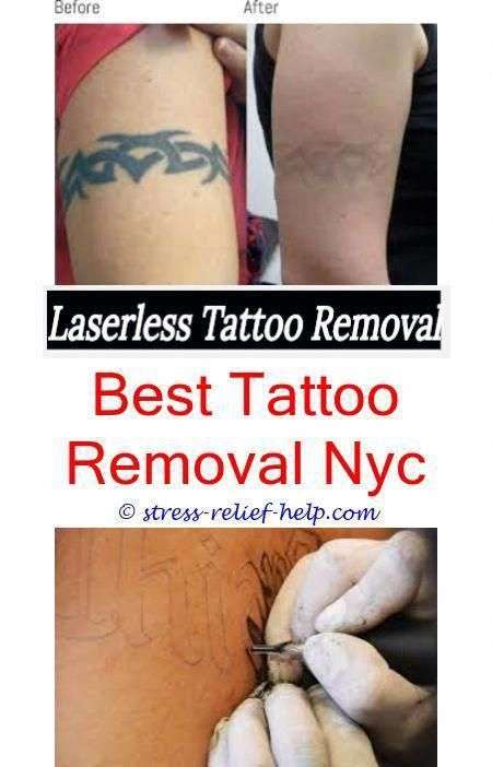 Can you get laser tattoo removal while pregnant.How to remove stick and ...