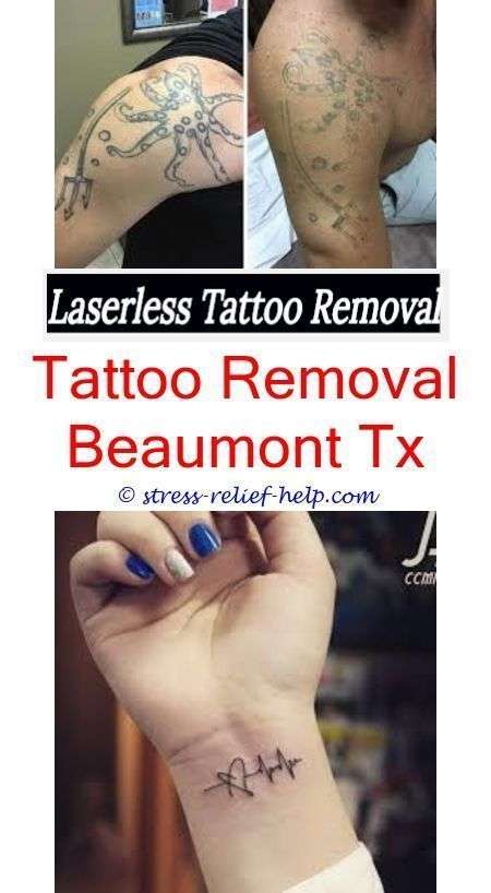 Can you remove and repeat a tattoo? Tattoo Kno  #Tattoos ...