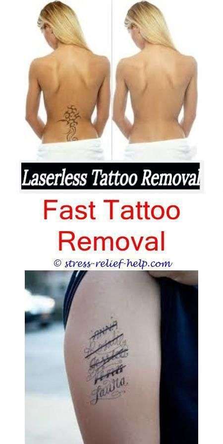 cheap tattoo removal how to remove a tattoo without a ...