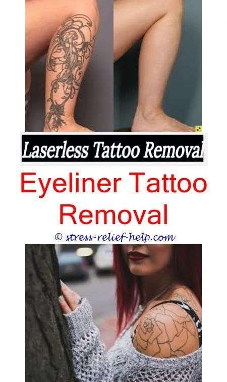 Color tattoo removal before and after.Tattoo removal north ...