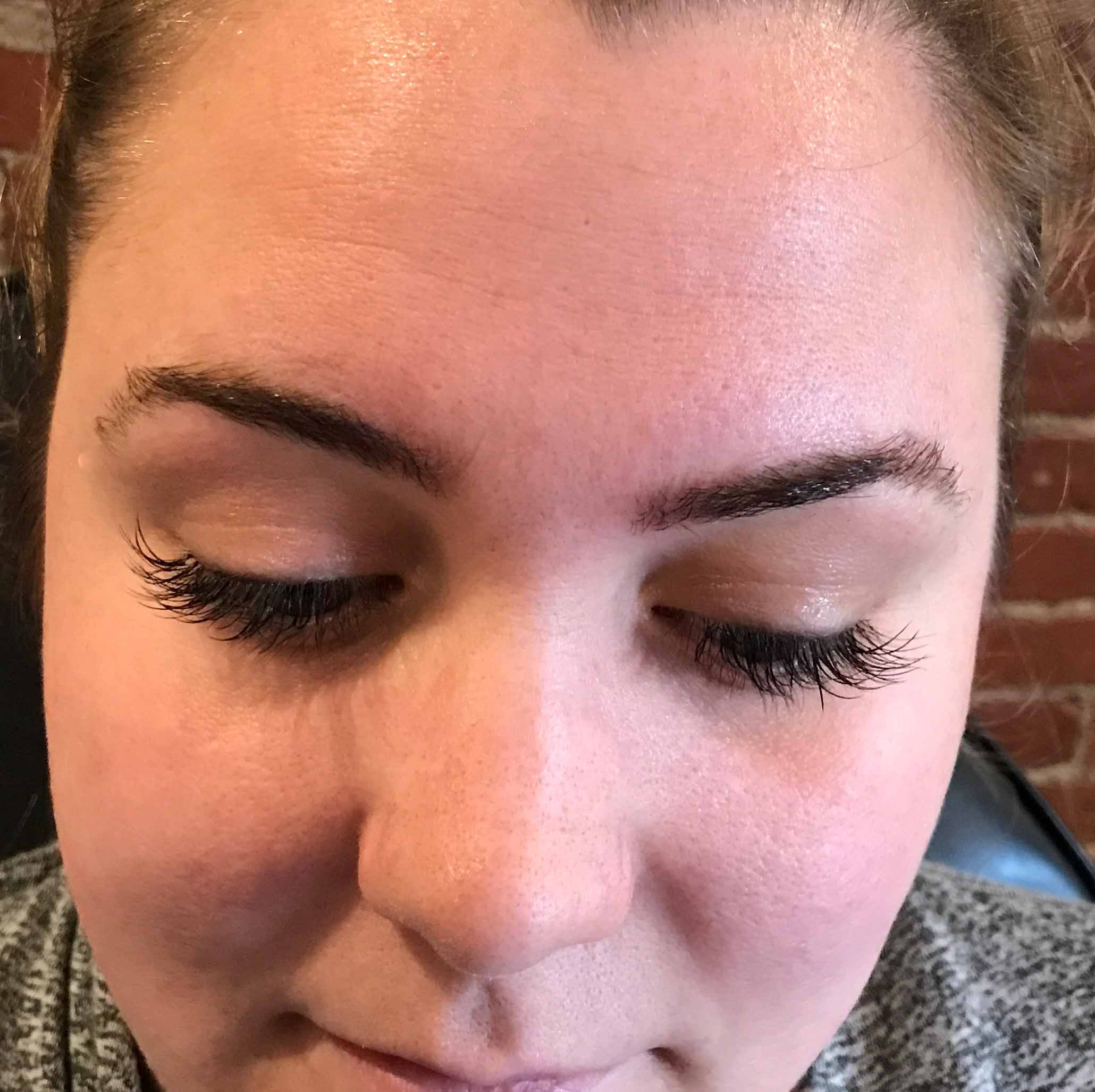 Cosmetic and Eyebrow Tattoo Removal