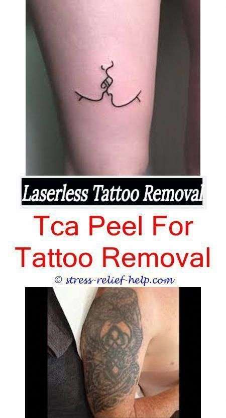cosmetic tattoo removal how does tattoo removal work yahoo