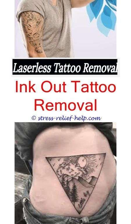cosmetic tattoo removal post tattoo removal
