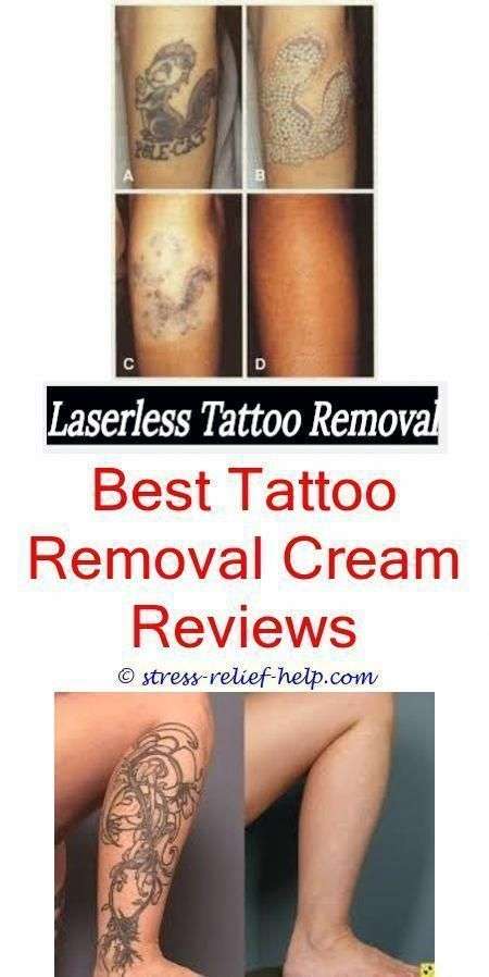 custom tattoo big tattoo removal before and after