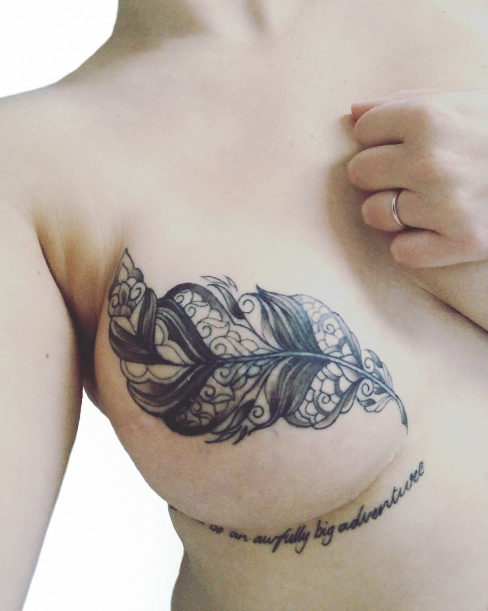 Decorative tattoos after breast cancer surgery