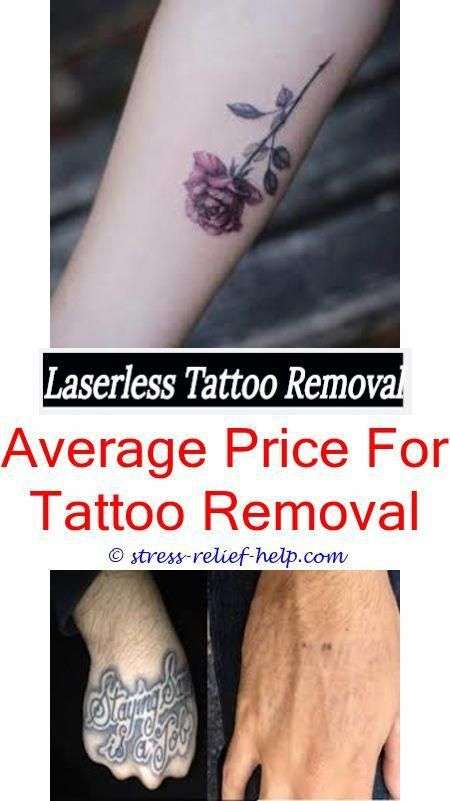Delete tattoo removal phoenix.How to remove a permanent ...