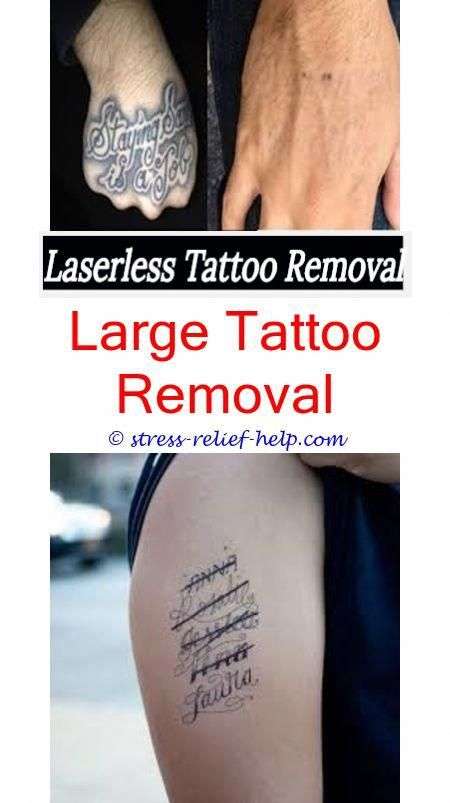 Do california require license for tattoo removal ...