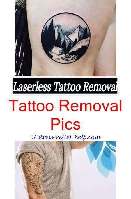 Do getting tattoos removed hurt.How painful is getting a tattoo removed ...