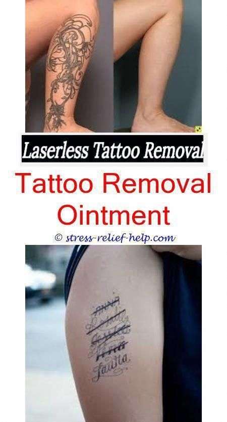 Does getting a tattoo removed hurt.Low cost laser tattoo removal.Tattoo ...