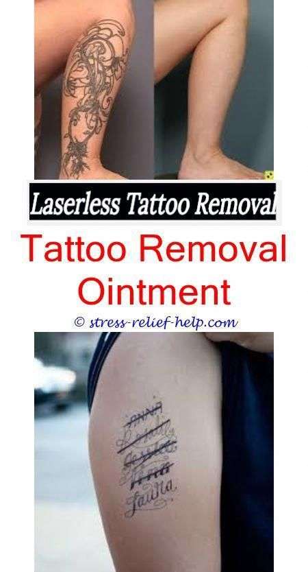 Does getting a tattoo removed hurt.Low cost laser tattoo ...