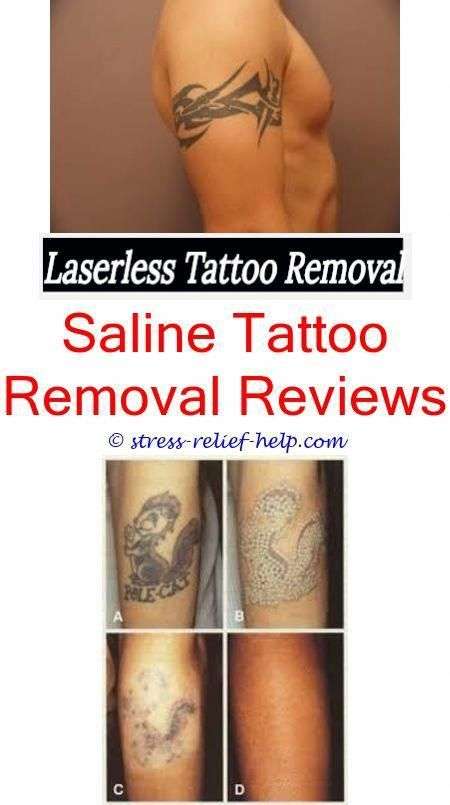 Does Health Insurance Cover Tattoo Removal
