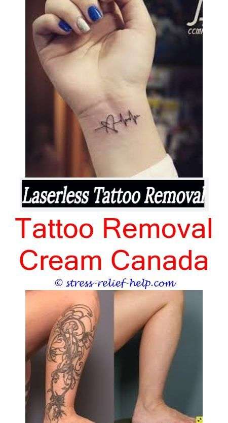 Does it hurt to get a tattoo removed.Does salt and water remove tattoos ...