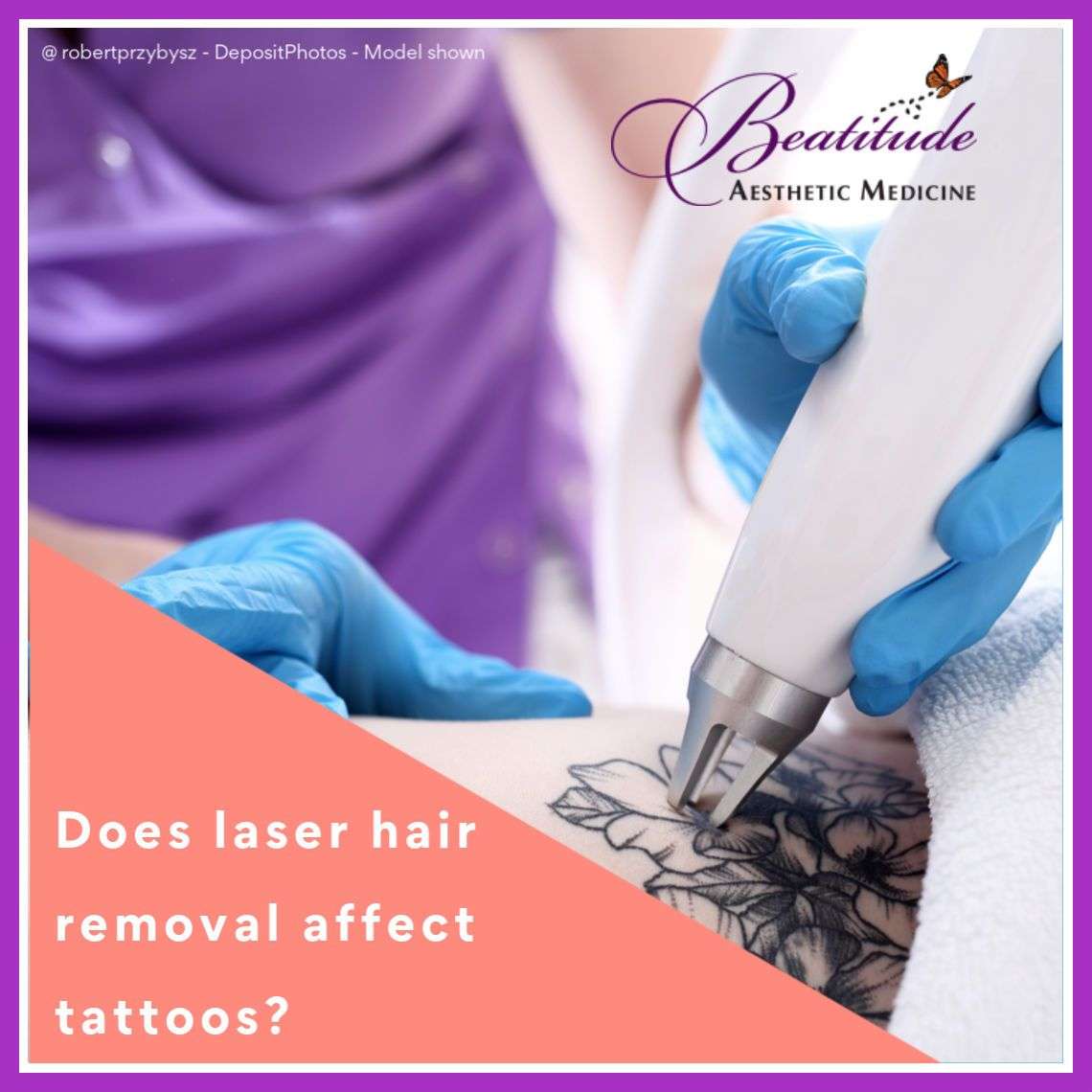 Does laser hair removal affect tattoo removal?