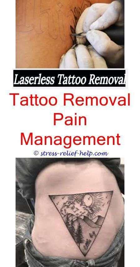 does laser tattoo removal hurt how deepika padukone ...