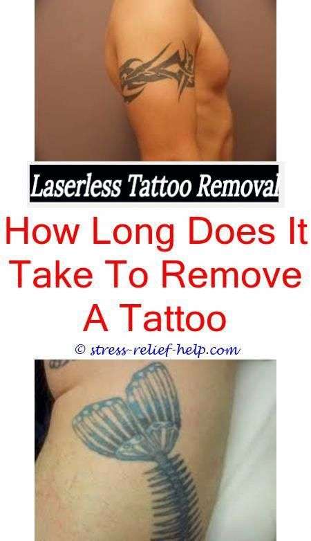 Does laser tattoo removal hurt.How to remove fresh tattoo ink from skin ...