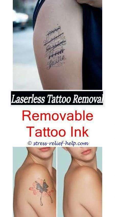 Does picosure tattoo removal hurt.How they remove tattoos ...