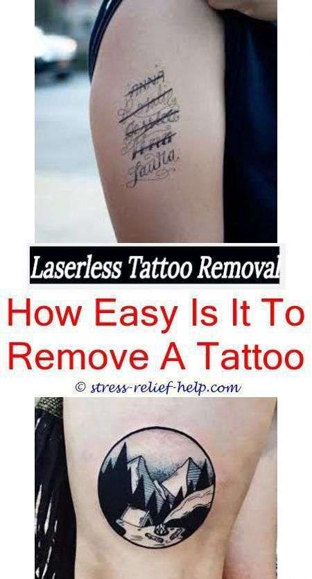 Does removing a tattoo hurt yahoo.How much does a laser tattoo removal ...