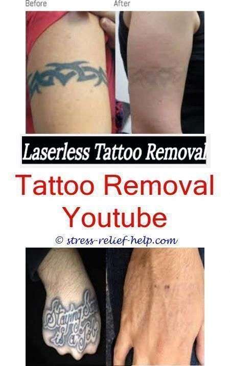 does tattoo removal cream work