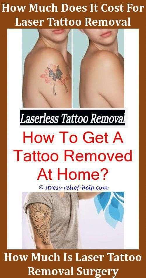 Easy Tattoo Removal Tattoo Removal Nyc Prices,tattoo ...
