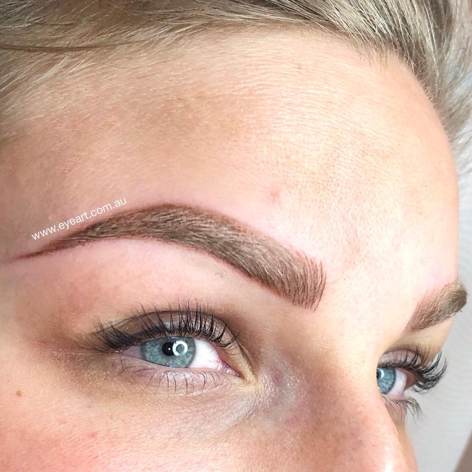 Eyebrow Botched Laser Tattoo Removal