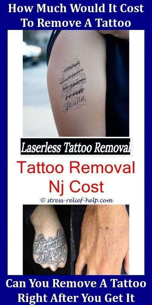 Fast Tattoo Removal How To Remove Fake Sticker Tattoos ...
