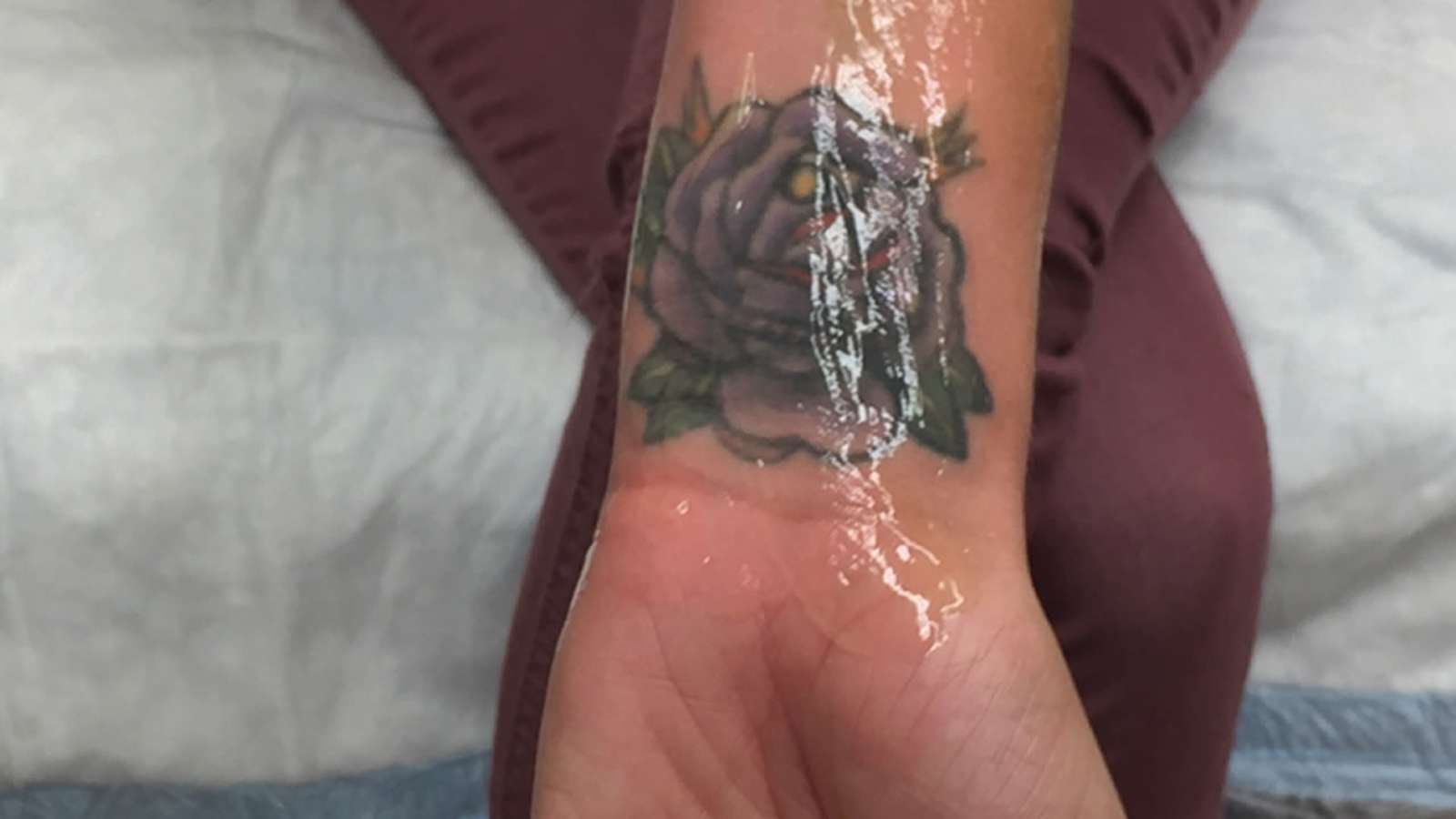 Gang tattoo removal program expands to help human trafficking victims ...