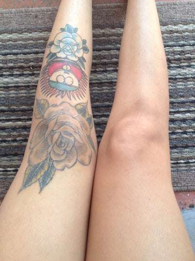 Get This off of Me! Picosure Laser Tattoo Removal on Knee ...