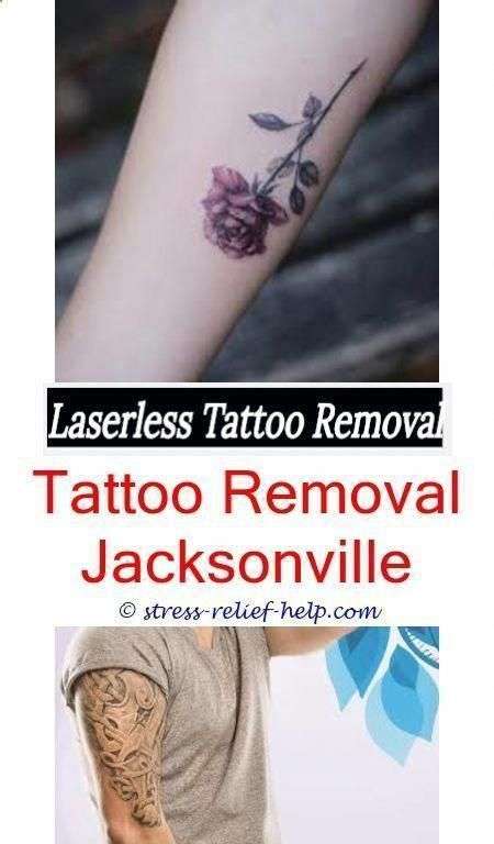 How Do I Become A Laser Tattoo Removal Technician