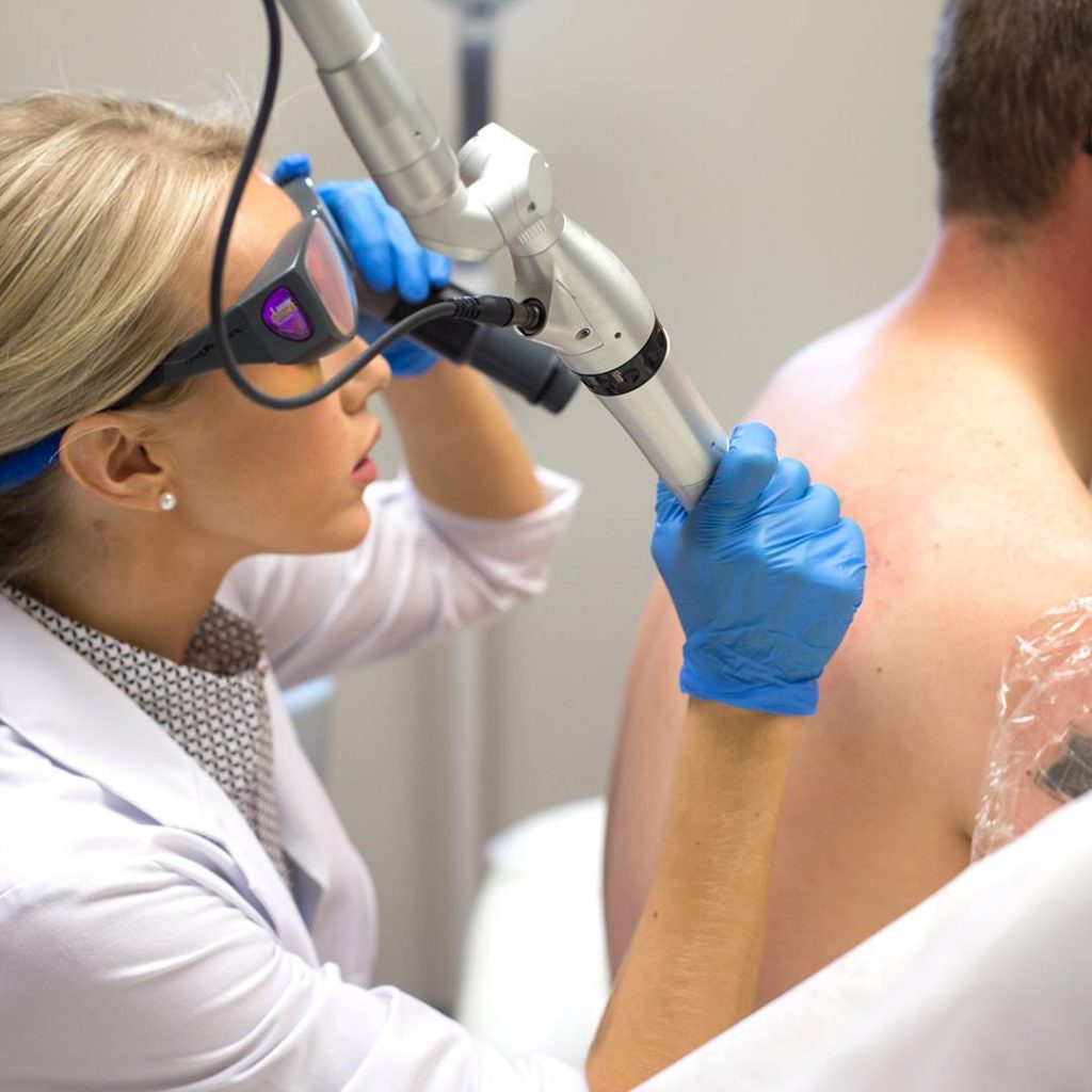 How Does Laser Tattoo Removal Actually Work?