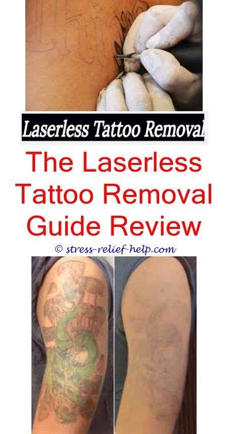 How effective is laser tattoo removal 2015.How to remove tattoo at home ...