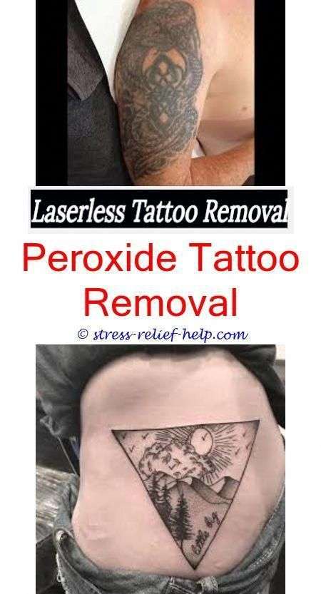 How hard to remove a tattoo.How to remove tattoos ...