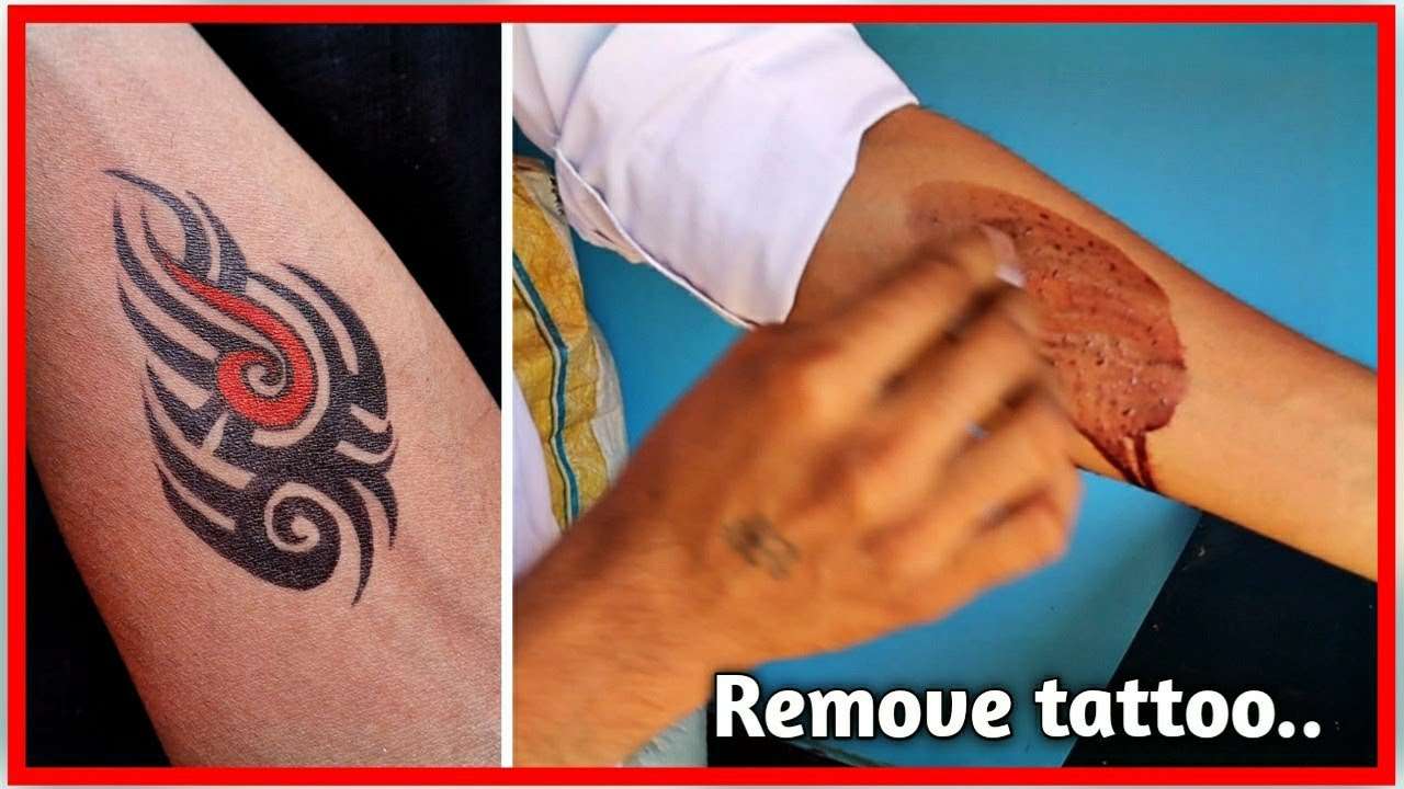 How I remove my temporary tattoos on my arms?