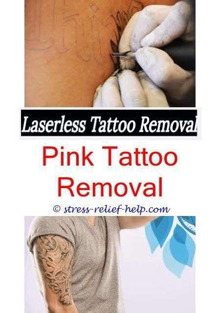 How long between tattoo removal sessions.Tattoo removal ...